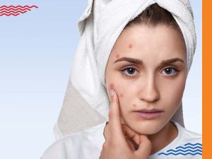 Be spot on with your anti-acne regimen