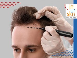 Trichologist