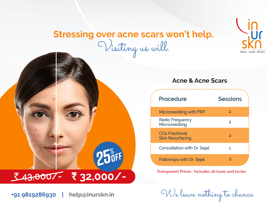 Smooth Out Your Skin's Story: Acne Scar Treatment @ InUrSkn