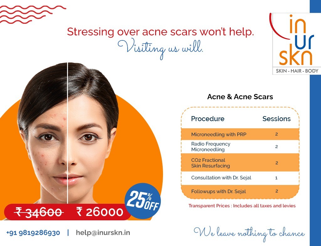Smooth Out Your Skin's Story: Acne Scar Treatment @ InUrSkn